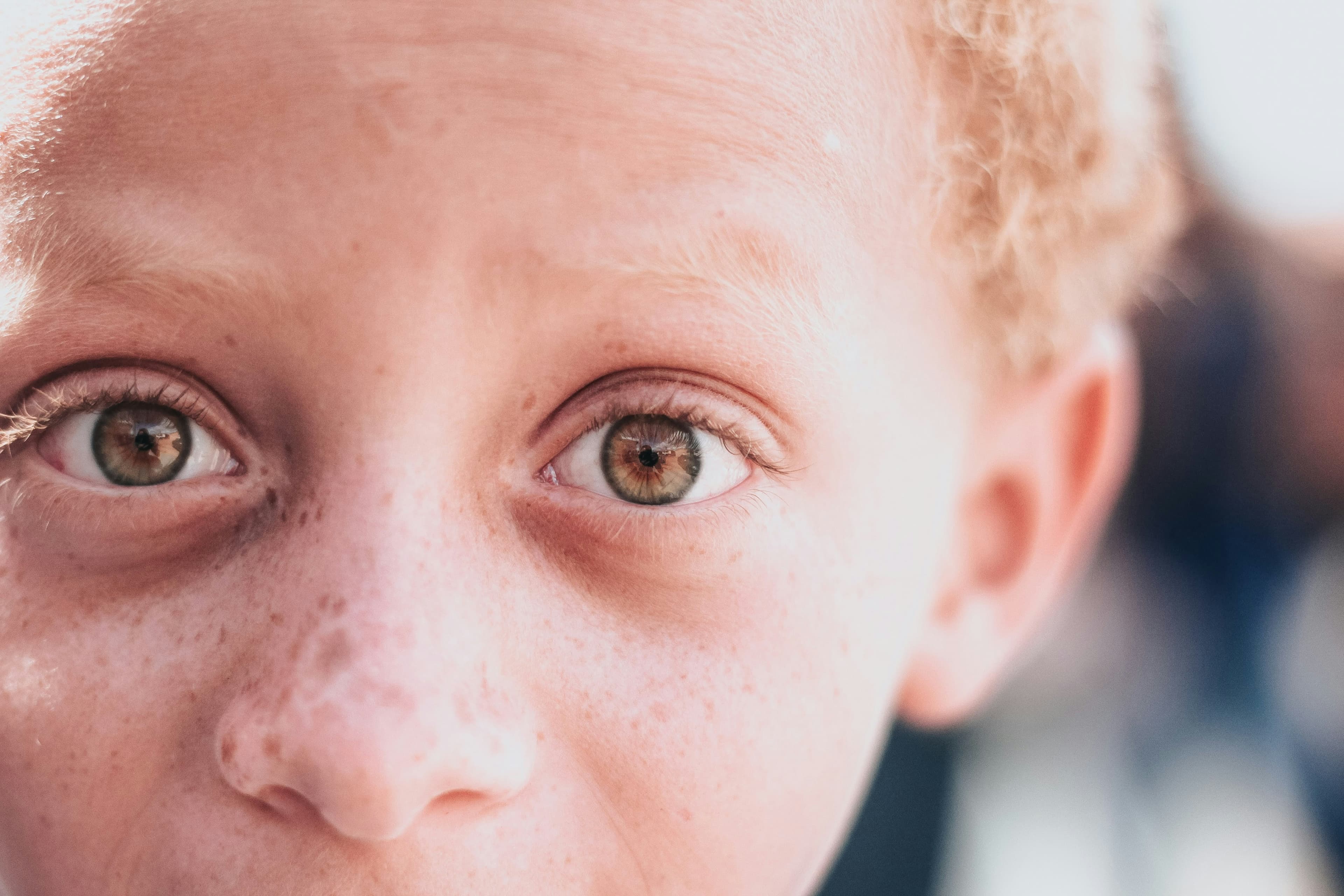 Child face close-up representing childhood vasculitis care